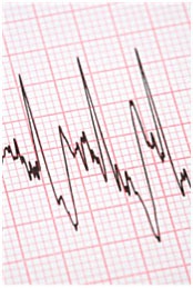 lines represent numerical data